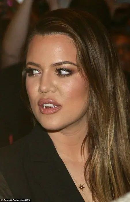 Hip hop: Khloe wore a golden grill on her bottom teeth to give her a fuller pout on the night: 