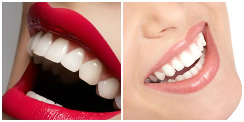El método mas efectivo para blanquear tus dientes en casa