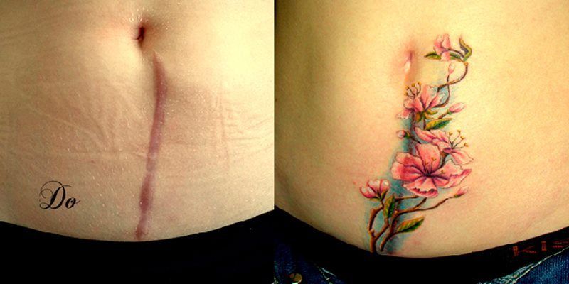 tatuajes para tapar cicatrices en el abdomen
