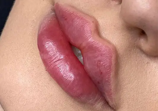 russian lips