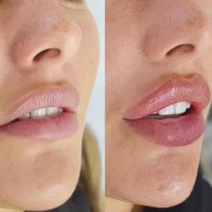 russian lips