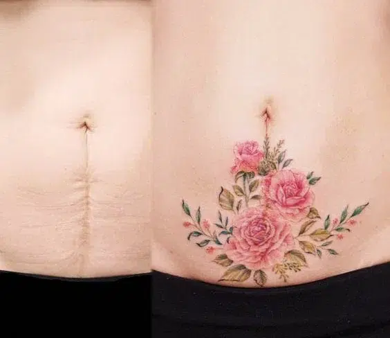 tatuajes para tapar cicatrices en el abdomen