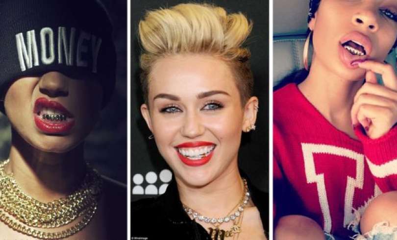 Grillz: 20 parrillas de oro y diamante que desearás tener