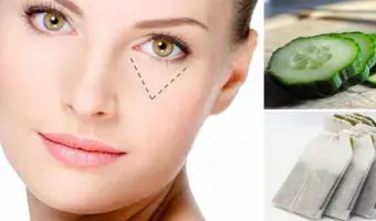 Cómo cuidar la piel sensible debajo de los ojos en casa