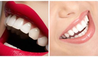 El método mas efectivo para blanquear tus dientes en casa